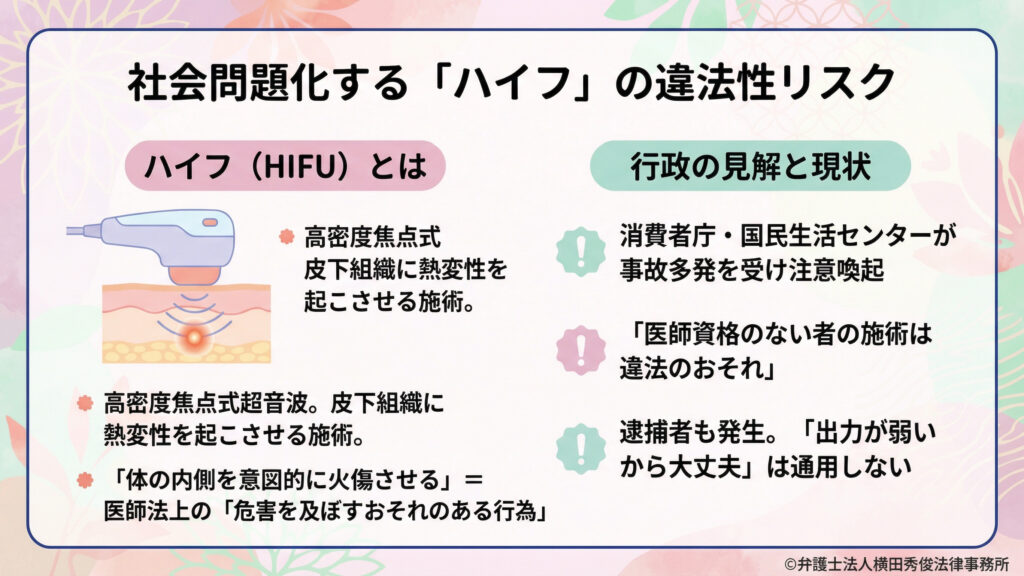 ハイフ（ＨＩＦＵ）の違法性リスク。皮下組織に熱変性を起こす施術で、無資格施術は違法のおそれ。事故多発や逮捕例も示す。